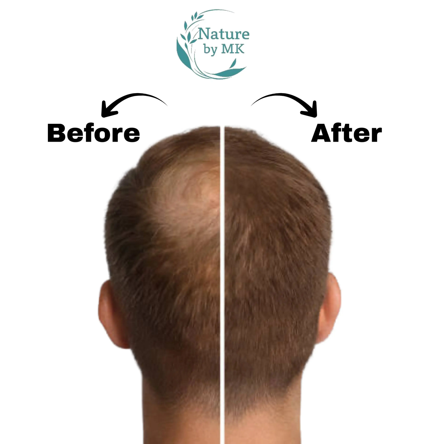 EvoBeauty Your Go To Garlic Hair Growth Bundle